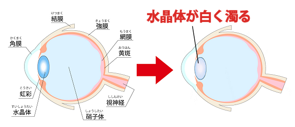 犬が罹る白内障とは？